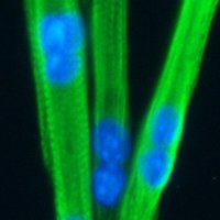 Skeletal Muscle Stem Cells & Regeneration(@MuSCandReg) 's Twitter Profile Photo