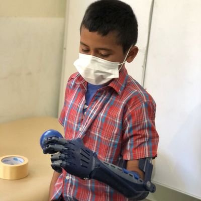 Soluciones Ortopédicas Impresas En 3D
Iniciativa Social Mi Prótesis 3D, El Salvador.