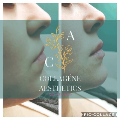 CollageneA's profile picture. Collagene Aesthetics is a Medical Spa in San Dimas, CA 91773