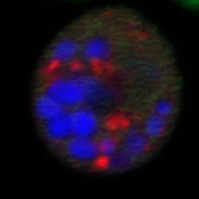 We study membrane trafficking linked to rare diseases by using yeast and cell lines.