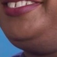 Stacy’s middle tooth gap, lower lip, and chins (@woodrow1921) 's Twitter Profile