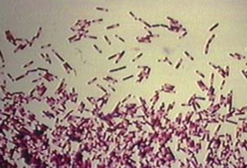 TheClostridiums's profile picture. A group of bacteria whose toxins cause everything from uncontrollable diarrhea to paralysis to worse things.