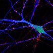 FGA lab VU/ Amsterdam UMC (@fga_lab) 's Twitter Profile Photo