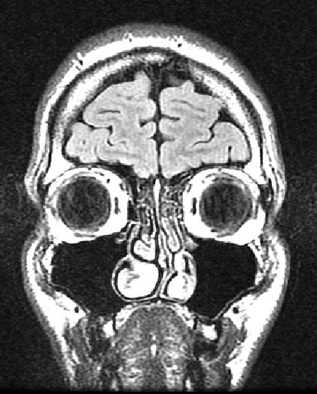 Professor @PolyMTL reinventing MRI and academic publishing. Creator of @qmrlab, @MRM_highlights, @OHBM blog, foundation @qantarot and https://t.co/9HFoEKCVX8