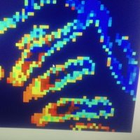 Lipids in Human Pathology (@lipids_idisba) 's Twitter Profile Photo Lipids in Human Pathology (@lipids_idisba) 's Twitter Profile Photo