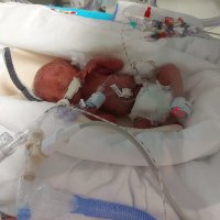 My_Miracle_24Weeker (@miracle24weeker) 's Twitter Profile Photo