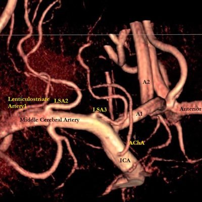 Keeping you updated about the exciting joint research activities of the @Cambridge_Uni Stroke Research Group & Addenbrooke's Hospital Stroke Unit.