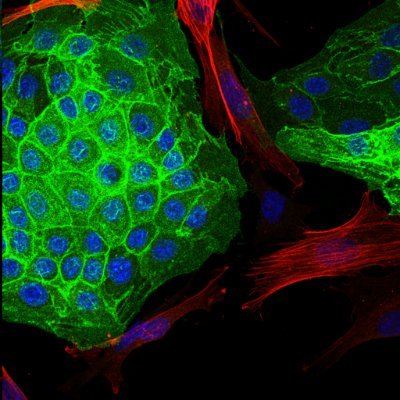 Laboratory focused on metabolic diseases, obesity and diabetes research at @IIBmCSICUAM and part of @CIBERDEM, led by Dr. Ángela M. Valverde