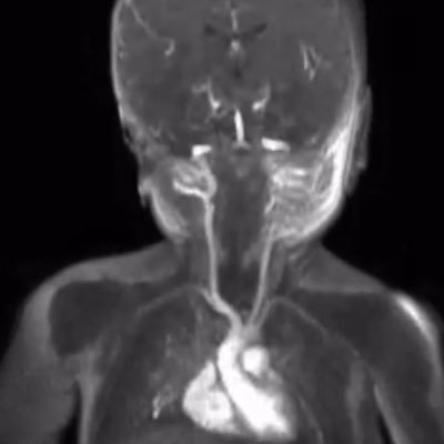 Professor @Berkeley_EECS. Computational MRI, Aims to eliminate the need for anesthesia in Pediatric MRI. https://t.co/LUVkzCd9vL, https://t.co/0imMUXHCCF