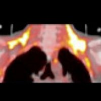 Human Brown Fat Research Group Turku (@bat_turku) Twitter profile photo