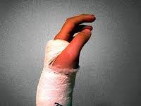 Affected by Mesothelioma due to Asbestos exposure? Injured at work? We help to connect people to the best lawyers for their needs.