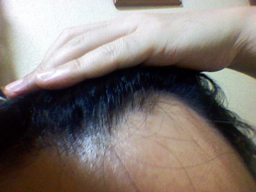 ハゲない４０代 Hagenai40dai Twitter