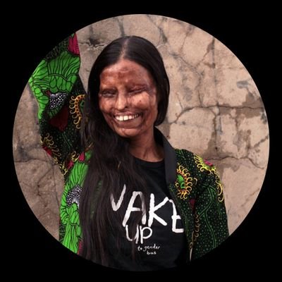 Neetu__offical's profile picture. Acid Attack Survivor | Campaigner for the Prevention of Gender-based Violence | Singer