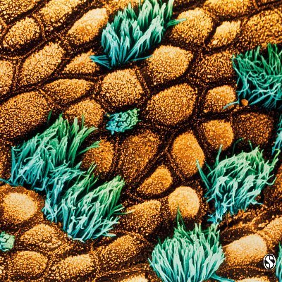 Therapeutic Advances in Respiratory Disease Profile