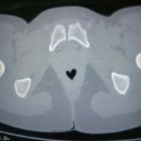 Anals of Interventional Radiology (@anals_of_ir) 's Twitter Profile