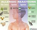 Get Allergies articles here