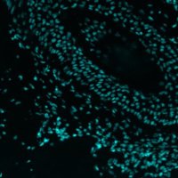 Fred Hutch Innovation Lab (@hutchinnovation) 's Twitter Profile