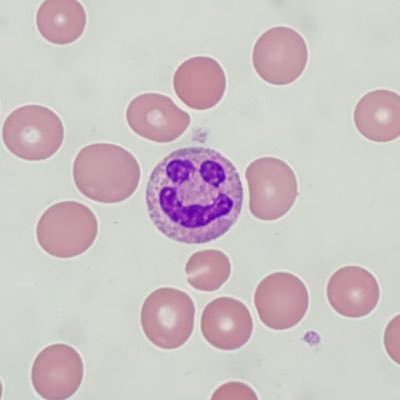 VariantLymph's profile picture. chief of pathology at Outside Community Hospital Medical Center. glass pusher. cell counter. has never gotten oil on the 40x.