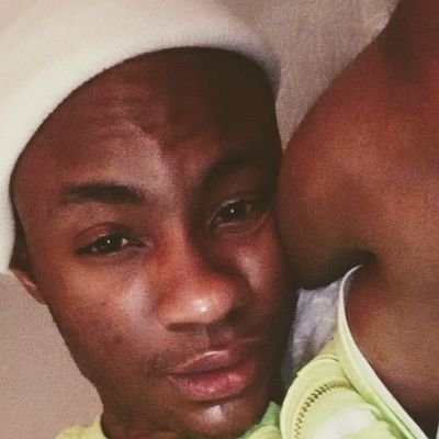 College Student Battling Colon Cancer and Still Remaining A King 💯