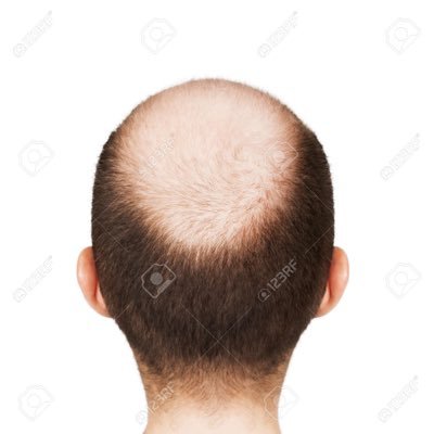 Posting a different bald/balding icon every day
