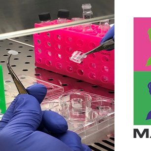 DermPlast is a research project funded by H2020. It will provide policymakers with reliable information on human dermal exposure to microplastic additives.