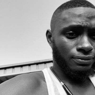 TOlutimileyin's profile picture. Creative Artist | THE VITILIGO GUY