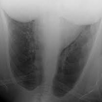 Documenting the poorest, strangest and certainly least clinically appropriate referrals to the radiology department. 

Submissions to rishowlers@gmail.com