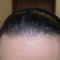 MT | 40歳からの育毛と美容の記録（AGA治療始めました） (@mt40_aga) Twitter profile photo