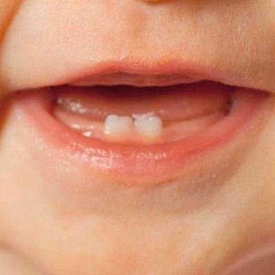 الصح لابد ان يكون صح ماعمر الخطاء يكون صح