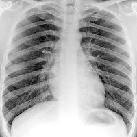 Radiology Masterclass (@radmasterclass) 's Twitter Profile