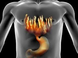 Group Dedicated to help with Acid reflux related issues, solutions and of course feedback. Help us manage this terrible issue. Visit our site for more info.