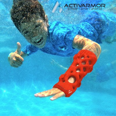 The only waterproof cast on the market! 3D Custom Printed casts/splints made in the USA and growing globally. Recyclable, Sanitizable & easy to scan via iPhone