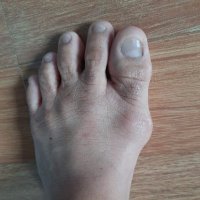 Gout Tips and Stories (@gout_blog) 's Twitter Profile