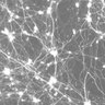 MordesLab's profile picture. Integrating neuropathology, stem cells, and multi-omics to study neurodegeneration #ALS #dementia @UCSFPath @INDUCSF 🧠🔬🌻