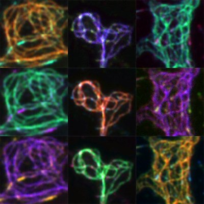 How do neurons develop and how are they maintained?
To understand this we investigate how signalling is translated into coordinated cytoskeletal changes.