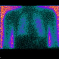 Applied Respiratory Research Group, Brunel Uni (@appliedrespbu) 's Twitter Profile