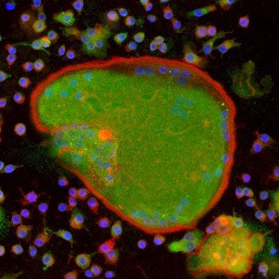 Our lab studies topics related to musculoskeletal oncology, radiobiology, bone tissue engineering and developmental biology of the skeleton.