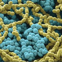 TransplantID Journal (@thetxidjournal) 's Twitter Profile Photo TransplantID Journal (@thetxidjournal) 's Twitter Profile Photo