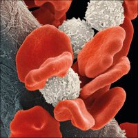 Therapeutic Advances in Hematology (@tahematol) 's Twitter Profile Photo Therapeutic Advances in Hematology (@tahematol) 's Twitter Profile Photo