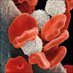 Therapeutic Advances in Hematology (@tahematol) Twitter profile photo Therapeutic Advances in Hematology (@tahematol) Twitter profile photo