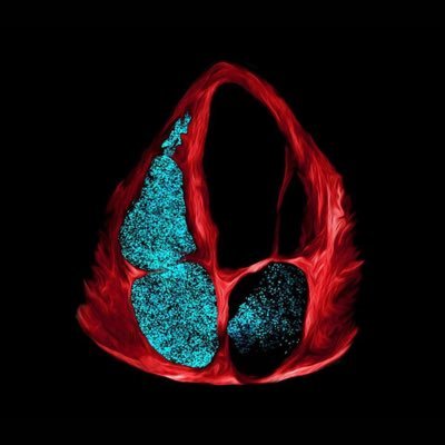 MenghorngEang's profile picture. សួស្តី I'm ready to learn!!!