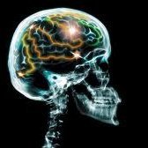 epilepsy facts & opinions (minds of an epileptic) (@guy_amv) 's Twitter Profile