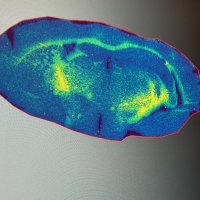MS_Imaging (@imaging_ms) 's Twitter Profile