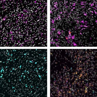 LmSpapers's profile picture. Continuous feed of the latest #Leiomyosarcoma papers and preprints from PubMed, bioRxiv and medRxiv. Twitterbot maintained by 
@Joseph_Carlson