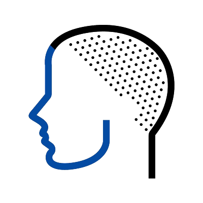 Expert Scalp Micropigmentation Professionals in the Tri-State Maryland, Washington DC, Virginia. Experts in the Micropigmentation Industry. 5 years in Business