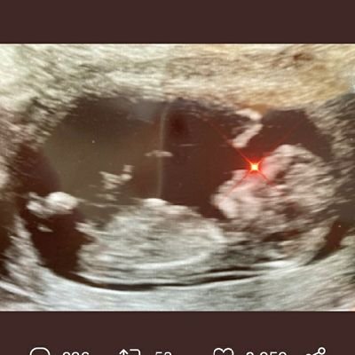 DiegoRa23162799's profile picture. gestor financeiro ; atendente de farmácia;criptos ;