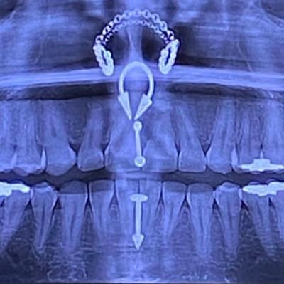 lukewarm_pizza's profile picture. 🏳️‍⚧️
daily feed dos meus pensamentos caóticos
she/her
sleepiest trans girl