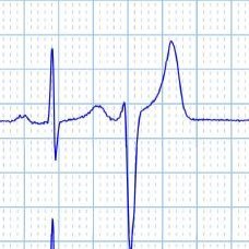 ECG Cases