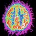ADHD/ASD Founder (@adhdasdfounder) Twitter profile photo ADHD/ASD Founder (@adhdasdfounder) Twitter profile photo