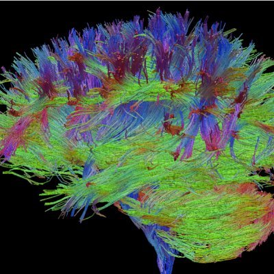 Neurodevelopment, Neuroimaging, MRI Acquisition & Analysis, Individual Differences & Twins, Open Science & Rstats @MCRI_for_kids @UniMelbMDHS